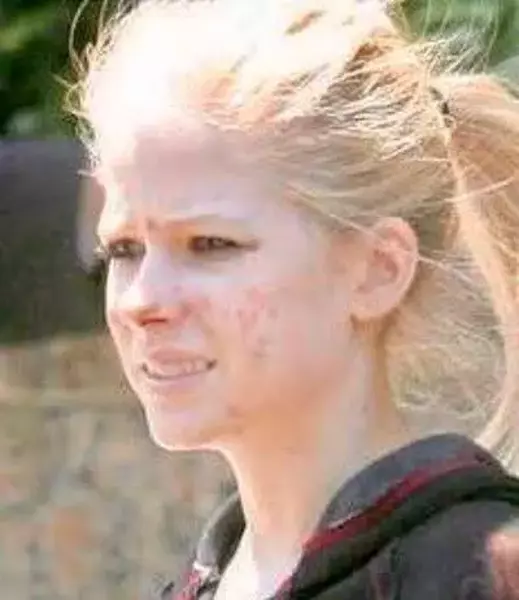 teenage Avril Lavigne without Makeup